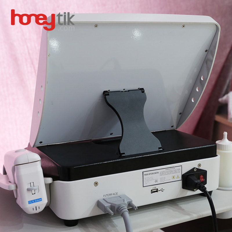 unlimited shots high intensity focused ultrasound hifu wrinkle removal machine