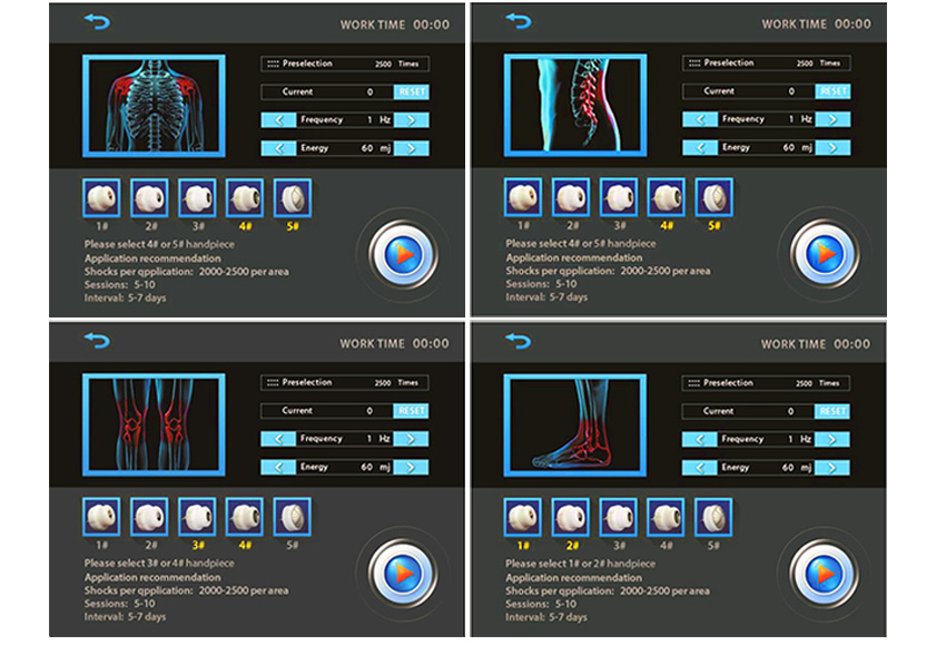 ed-treatment-acoustic-shock-wave-zimmer-shockwave-therapy-machine